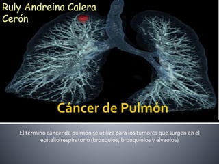 El término cáncer de pulmón se utiliza para los tumores que surgen en el
epitelio respiratorio (bronquios, bronquíolos y alveolos)
Ruly Andreina Calera
Cerón
 