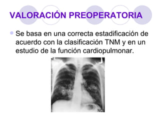 VALORACIÓN PREOPERATORIA
   Se basa en una correcta estadificación de
    acuerdo con la clasificación TNM y en un
    estudio de la función cardiopulmonar.
 