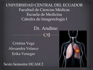 Cristina Vega
Alexandra Velasco
Erika Venegas
Sexto Semestre HCAM 2
Dr. Andino
 