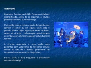 Tratamento
Quando o Carcinoma de Não Pequenas Células é
diagnosticado, antes de se espalhar, a cirurgia
pode determinar a cura da doença.
O cirurgião poderá retirar a parte do pulmão que
contém o tumor ou em alguns casos todo o
pulmão (de um lado). Alguns pacientes recebem,
depois da cirurgia, radioterapia, quimioterapia
ou ambos, para eliminar qualquer célula tumoral
residual.
A cirurgia raramente é uma opção para
pacientes com Carcinoma de Pequenas Células
devido ao fato de a doença geralmente ser
inoperável no momento do diagnóstico.
Nestes casos, é mais freqüente o tratamento
quimioradioterápico
 