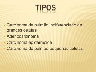 TIPOS
 Carcinoma de pulmão indiferenciado de
grandes células
 Adenocarcinoma
 Carcinoma epidermoide
 Carcinoma de pulmão pequenas células
 