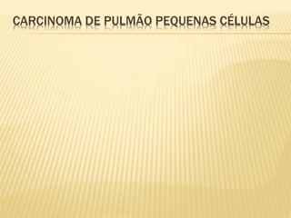 CARCINOMA DE PULMÃO PEQUENAS CÉLULAS
 