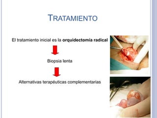 TRATAMIENTO
El tratamiento inicial es la orquidectomía radical
Biopsia lenta
Alternativas terapéuticas complementarias
 