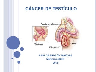 CÁNCER DE TESTÍCULO
CARLOS ANDRÉS VANEGAS
Medicina-USCO
2015
 