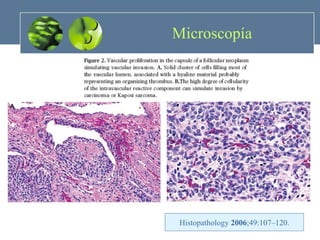 Microscopía Histopathology  2006 ;49:107–120. 