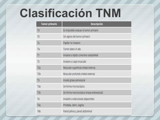 Clasificación TNM
 