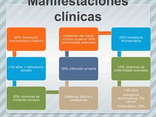 Manifestaciones
clínicas
80% hematuria
macroscópica indolora
>50 años + hematuria:
estudio
20% síntomas de
irritación urinaria
Urgencia, disuria y
polaquiuria
30% Infección urinaria
Dilatación del tracto
urinario superior 50%
enfermedad avanzada
20% hematuria
microscópica
10% síntomas de
enfermedad avanzada
>50 años
hematuria
asintomática: 5%
cáncer
Sintomática: 10%
 