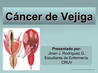 Cáncer de VejigaCáncer de Vejiga
Presentado por:
Jinan J. Rodríguez G.
Estudiante de Enfermería.
CRUV
 
