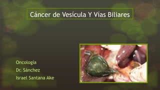 Cáncer de Vesícula Y Vías Biliares
Oncología
Dr. Sánchez
Israel Santana Ake
 
