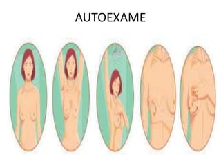 AUTOEXAME
 