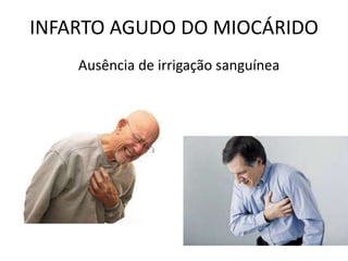 INFARTO AGUDO DO MIOCÁRIDO
Ausência de irrigação sanguínea
 