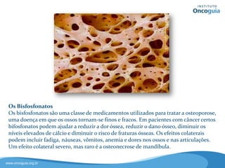 Bisfosfonatos
Os bisfosfonatos são uma classe
de medicamentos utilizados para
tratar a osteoporose, uma doença
em que os ossos tornam-se finos e
fracos.
Em pacientes com câncer, certos
bisfosfonatos podem ajudar a reduzir
a dor além do dano ósseo, e podem
diminuir também os níveis de cálcio e
os riscos de fraturas.
Os efeitos colaterais da medicação podem incluir fadiga, náuseas,
vômitos, anemia e dores nos ossos e nas articulações. Ou efeito
colateral grave, entretanto raro, é a osteonecrose de mandíbula.
 