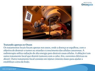 Tratando os Ossos
Os tratamentos locais tem como
objetivo destruir o tumor ou
retardar o crescimento das suas
células e focam apenas nos ossos, ou
seja, onde encontra-se a doença.
A radioterapia utiliza radiação de
alta energia para destruir essas
células.
A ablação é outro tipo de tratamento
local que destrói tumores com calor,
frio, correntes elétricas ou álcool.
Outro tratamento local consiste em injetar cimento ósseo para
ajudar a estabilizar a área da lesão.
 