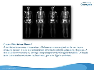 Você sabe o que é
Metástase Óssea ?
As metástases ocorrem quando as
células cancerígenas originárias de um
tumor primário, por exemplo, mama
ou pulmão, deixam o local e se
disseminam para outros órgãos
distantes através do sistema sanguíneo
e linfático.
Os locais mais comuns de
metástases incluem osso, pulmão,
fígado e cérebro.
 