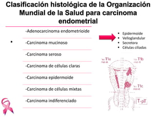 . 
-Adenocarcinoma endometrioide 
-Carcinoma mucinoso 
-Carcinoma seroso 
-Carcinoma de células claras 
-Carcinoma epidermoide 
-Carcinoma de células mixtas 
-Carcinoma indiferenciado 
 Epidermoide 
 Velloglandular 
 Secretora 
 Células ciliadas 
 