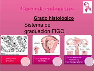 Grado histológico 
Sistema de 
graduación FIGO 
Grado 1 buen 
pronóstico 
Grado 2 pronóstico 
intermedio. 
Grado 3 invasión 
miometrial y 
metástasis ganglionar. 
 