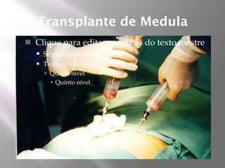 Transplante de Medula
   Clique para editar os estilos do texto mestre
       Segundo nível
       Terceiro nível
         Quarto nível
           Quinto nível
 