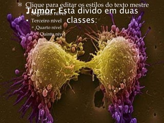    Clique para editar os estilos do texto mestre
    Tumor: Está divido em duas
     Segundo nível
     Terceiro nível classes:
       Quarto nível
         Quinto nível
 