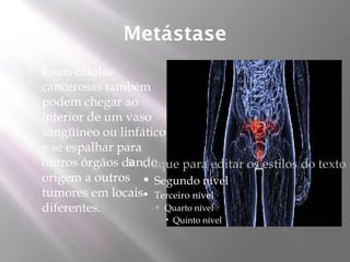 Metástase
   Essas células
    cancerosas também
    podem chegar ao
    interior de um vaso
    sangüíneo ou linfático
    e se espalhar para
    outros órgãos dando
                    Clique para editar os estilos do texto m
    origem a outros  Segundo nível
    tumores em locais Terceiro nível
    diferentes.          Quarto nível
                           Quinto nível
 