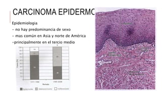 CARCINOMA EPIDERMOIDE
Epidemiologia
- no hay predominancia de sexo
- mas común en Asia y norte de América
-principalmente en el tercio medio
 