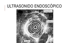 ULTRASONIDO ENDOSCÓPICO
 