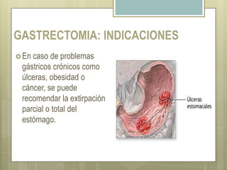 EVIDENCIAS DE METASTASISExamen clínicoRx. de tóraxPruebas de función hepática TAC: De tórax y abdomenMala para detectar metástasis de menos de 5 mm de diámetro, y la profundidad de la invasión tumoralEcografía endoscópicaLa profundidad de la visión es de solo 5cm