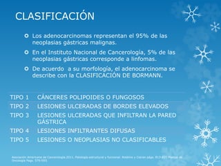 CLASIFICACIÓN
 Los adenocarcinomas representan el 95% de las
neoplasias gástricas malignas.
 En el Instituto Nacional de Cancerología, 5% de las
neoplasias gástricas corresponde a linfomas.
 De acuerdo a su morfología, el adenocarcinoma se
describe con la CLASIFICACIÓN DE BORMANN.
Asociación Americana de Cancerología.2011. Patología estructural y funcional. Robbins y Cotran págs. 813-831.Manual de
Oncología Pags. 579-593.
TIPO 1 CÁNCERES POLIPOIDES O FUNGOSOS
TIPO 2 LESIONES ULCERADAS DE BORDES ELEVADOS
TIPO 3 LESIONES ULCERADAS QUE INFILTRAN LA PARED
GÁSTRICA
TIPO 4 LESIONES INFILTRANTES DIFUSAS
TIPO 5 LESIONES O NEOPLASIAS NO CLASIFICABLES
 