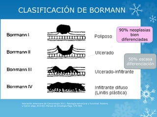CLASIFICACIÓN DE BORMANN
Asociación Americana de Cancerología.2011. Patología estructural y funcional. Robbins
y Cotran págs. 813-831.Manual de Oncología Pags. 579-593.
90% neoplasias
bien
diferenciadas
50% escasa
diferenciación
 