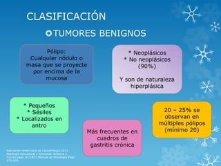 CLASIFICACIÓN
TUMORES BENIGNOS
Asociación Americana de Cancerología.2011.
Patología estructural y funcional. Robbins y
Cotran págs. 813-831.Manual de Oncología Pags.
579-593.
Pólipo:
Cualquier nódulo o
masa que se proyecte
por encima de la
mucosa
* Neoplásicos
* No neoplásicos
(90%)
Y son de naturaleza
hiperplásica
Más frecuentes en
cuadros de
gastritis crónica
20 – 25% se
observan en
múltiples pólipos
(mínimo 20)
* Pequeños
* Sésiles
* Localizados en
antro
 