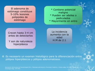  Es necesario un examen histológico para la diferenciación entre
pólipos hiperplásicos y pólipos adenomatosos.
Asociación Americana de Cancerología.2011. Patología estructural y funcional. Robbins y Cotran págs. 813-831.Manual de
Oncología Pags. 579-593.
El adenoma de
estómago constituye
5-10% lesiones
polipoides de
estómago
Crecen hasta 3-4 cm
antes de detectarlos
Y son de naturaleza
hiperplásica
La incidencia
aumenta con la
edad
H:M de 2:1
* Contiene potencial
maligno
* Pueden ser sésiles o
pediculados
* Mayormente en antro
 