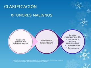 CLASIFICACIÓN
TUMORES MALIGNOS
Asociación Americana de Cancerología.2011. Patología estructural y funcional. Robbins
y Cotran págs. 813-831.Manual de Oncología Pags. 579-593.
Tumores
mesenquimales 2%
* Tumores de la
estroma
gastrointestinal
* Leiomiosarcoma
* Schwannoma
Linfomas 4%
Carcinoides 3%
Carcinoma
gástrico, más
frecuente 90-95%
 