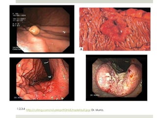 1,2,3,4 http://i.ytimg.com/vi/LaMqvr9OHUE/hqdefault.jpg; Dr. Murra.
 