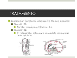 TRATAMIENTO
 La disección ganglionar se basa en la técnica japonesa:
 Disección D1:
 Ganglios perigástricos. Estaciones 1-6.
 Disección D2:
 D1 más ganglios celiacos y la serosa de la transcavidad
de los epiplones
 