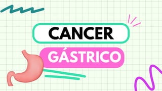 CANCER
GÁSTRICO
 