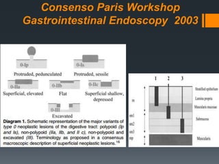 Consenso Paris Workshop
Gastrointestinal Endoscopy 2003
 