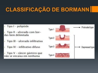 CLASSIFICAÇÃO DE BORMANN
 