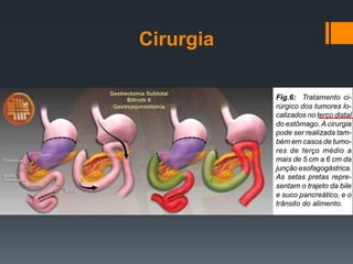 Cirurgia
 