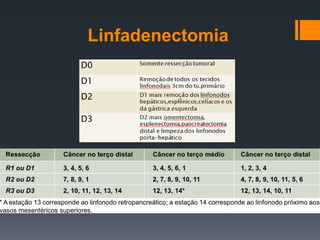 Linfadenectomia
 