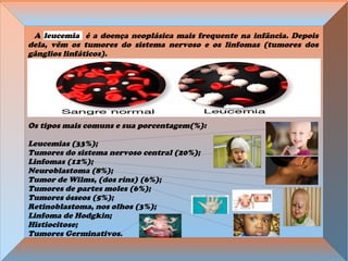 A leucemia é a doença neoplásica mais frequente na infância. Depois
dela, vêm os tumores do sistema nervoso e os linfomas (tumores dos
gânglios linfáticos).
Os tipos mais comuns e sua porcentagem(%):
Leucemias (33%);
Tumores do sistema nervoso central (20%);
Linfomas (12%);
Neuroblastoma (8%);
Tumor de Wilms, (dos rins) (6%);
Tumores de partes moles (6%);
Tumores ósseos (5%);
Retinoblastoma, nos olhos (3%);
Linfoma de Hodgkin;
Histiocitose;
Tumores Germinativos.
 