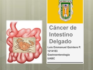 Cáncer de
Intestino
Delgado
Luis Emmanuel Quintero P.
1214183
Gastroenterología
UABC
 