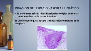 INVASIÓN DEL ESPACIO VASCULAR LINFÁTICO
› Se denomina así a la identificación histológica de células
tumorales dentro de vasos linfáticos.
Es un elemento que anticipa la reaparición temprana de la
neoplasia
 