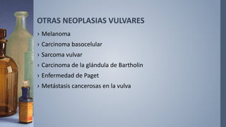 OTRAS NEOPLASIAS VULVARES
› Melanoma
› Carcinoma basocelular
› Sarcoma vulvar
› Carcinoma de la glándula de Bartholin
› Enfermedad de Paget
› Metástasis cancerosas en la vulva
 