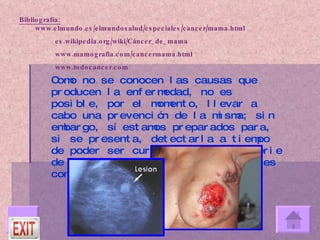 Bibliografía:  www.elmundo.es/elmundosalud/especiales/cancer/mama.html    es.wikipedia.org/wiki/Cáncer_de_mama   www.mamografia.com/cancermama.html   www.todocancer.com Como no se conocen las causas que producen la enfermedad, no es posible, por el momento, llevar a cabo una prevención de la misma; sin embargo, sí estamos preparados para, si se presenta, detectarla a tiempo de poder ser curada. Existe una serie de aspectos, en este sentido, que es conveniente tener presente. 