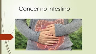 Câncer no intestino
 