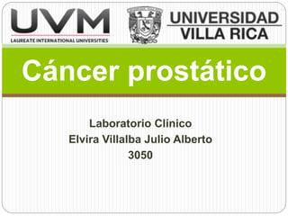 Laboratorio Clínico
Elvira Villalba Julio Alberto
3050
Cáncer prostático
 