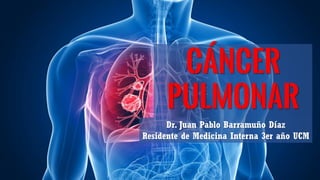Dr. Juan Pablo Barramuño Díaz
Residente de Medicina Interna 3er año UCM
Cáncer
Pulmonar
 