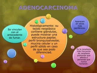 Histológicamente: su 
tejido neoplásico 
contiene glándulas, 
puede mostrar una 
estructura papilar, 
perfil bronquioalveolar, 
mucina celular y un 
perfil sólido en caso 
de que sea podo 
diferenciad. 
Se vinculan 
con el 
antecedente 
de fumar. 
Aparecen 
en sitios 
más 
periféricos. 
Es la neoplasia 
más frecuente 
de neoplasia 
pulmonar que 
afecta a 
personas que 
nunca 
fumaron. 
 