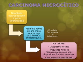 Neoplasia 
neuroendocrin 
a poco 
diferenciada 
Asume la forma 
de una masa 
central con 
proliferación 
endobronqueal. 
• Vinculada 
fuertemente 
al 
tabaquismo 
Sus células: 
- Citoplasma escaso 
- Pequeños núcleos 
hipercromáticos con una 
disposición fina de cromatina 
- Nucléolos sobresalientes 
 