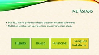 METÁSTASIS
• Mas de 2/3 de los pacientes en fase lV presentan metástasis pulmonares
• Metástasis hepáticas son hipervasculares, se observan en fase arterial
Hígado Hueso Pulmones
Ganglios
linfáticos.
 
