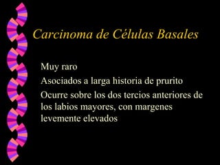 Carcinoma de Células Basales
Muy raro
Asociados a larga historia de prurito
Ocurre sobre los dos tercios anteriores de
los labios mayores, con margenes
levemente elevados
 